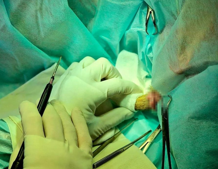 俄男后脑突长出“12公分恶魔角”吓呆外科医生：行医25年从未见过