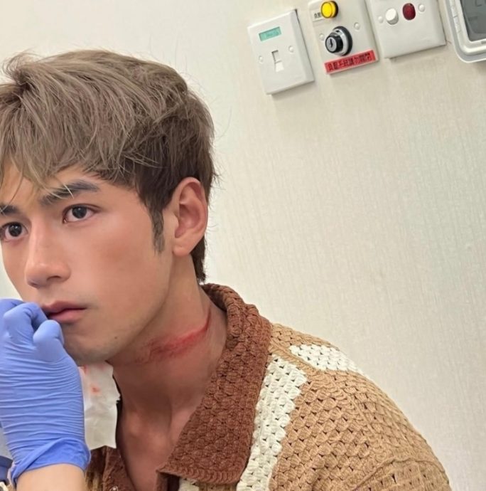 出海拍戏弃“替身”致受伤 魏浚笙报平安：在康复路上