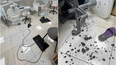 壮男因洗牙太痛攻击女牙医 诊所血迹斑斑一团糟