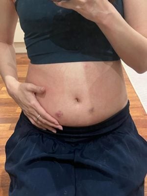 大都会/母亲节特稿（试管妈妈的坚韧）