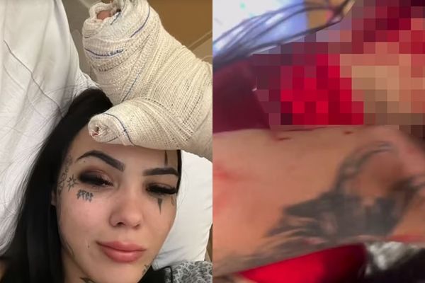 女网红直播中提分手 遭男友连砍9刀