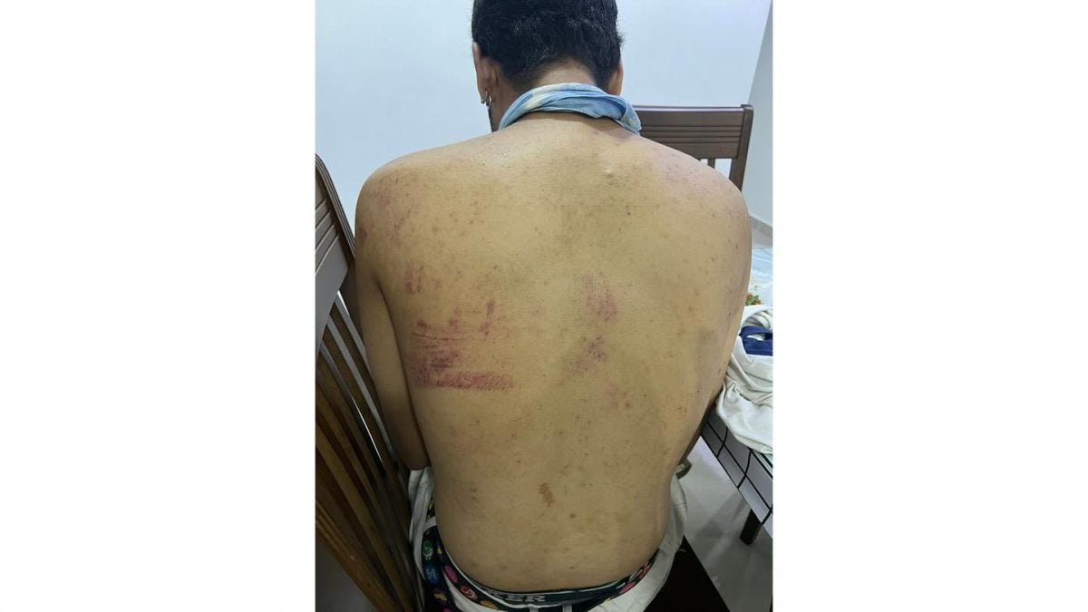 已签发 柔:被指未行吻手礼 乐团主唱男厕外遭多男伏击围殴