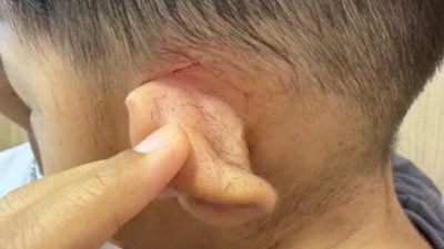 幼童理发遭割伤耳    母诉老板“若无其事”