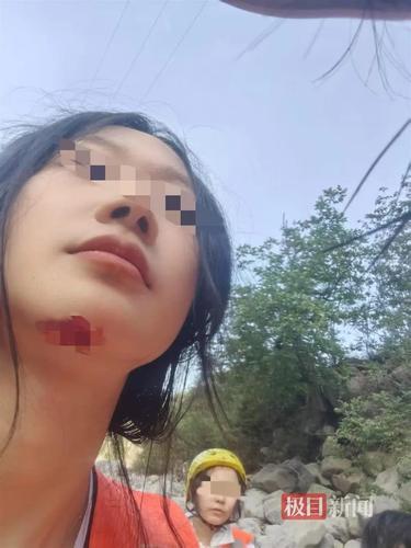 拚图两图)五一陜西漂流船翻侧多人受伤 游客险被石头割喉