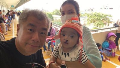 10年免费缝合2089裂唇病人 他让柬埔寨重拾微笑