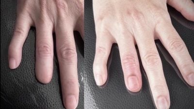 暖势力 | 她只想少一点异样眼光  刺青师为女子画上“遗失的指甲”