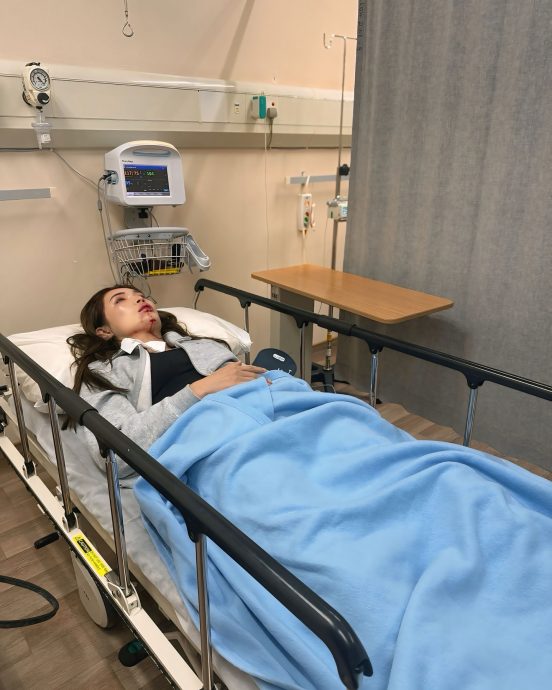 疑再因工作疲劳晕倒 Amber Chia下巴受伤入院动手术