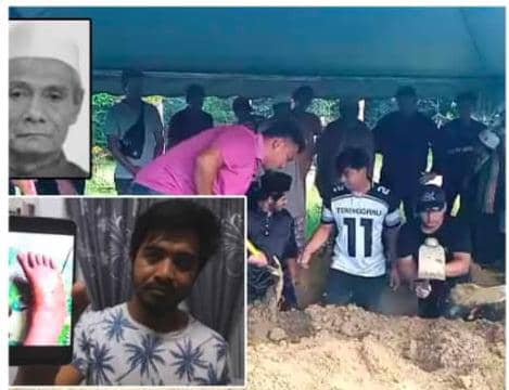 疑被毒性动物咬伤后三条血管堵塞  巫裔男子死于心脏衰竭