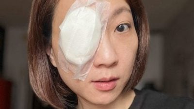 皓敏视网膜剥离 左眼紧急接受手术