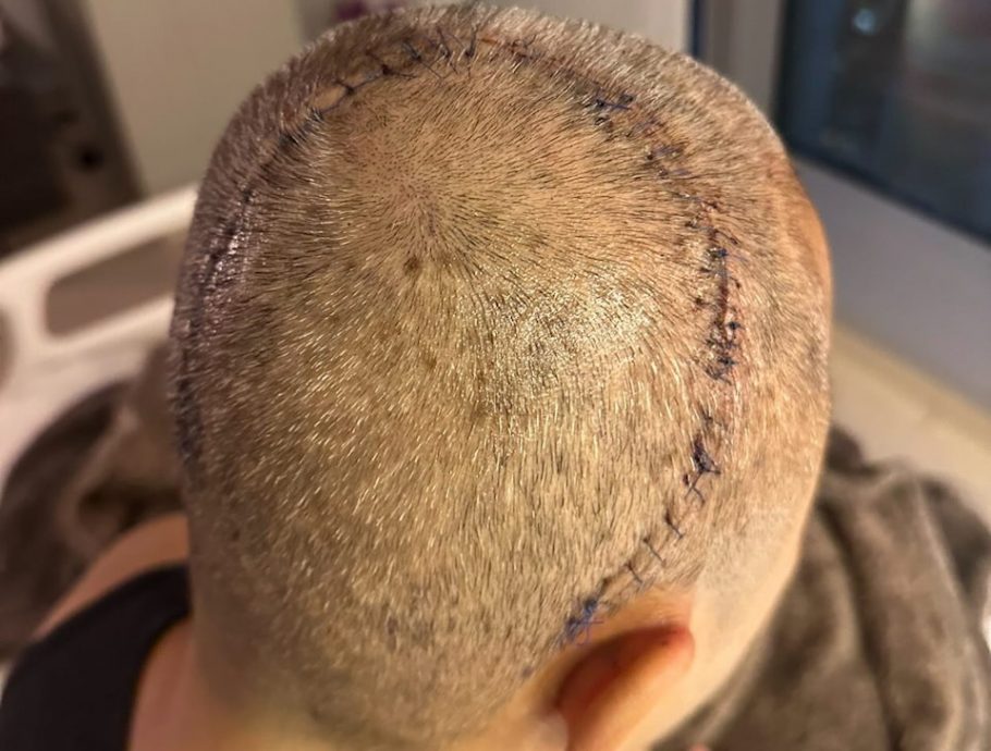 蔡一杰术后罕见公开现身 见证偶像50周年个唱