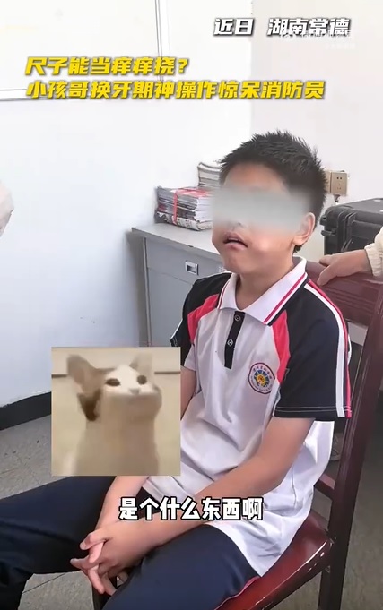 视频|男孩换牙期神操作！嘴卡三角尺全网傻眼