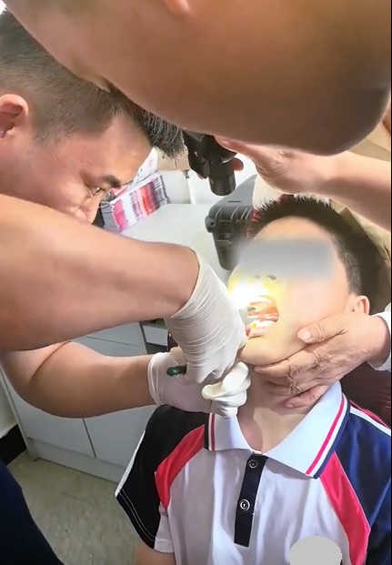 视频|男孩换牙期神操作！嘴卡三角尺全网傻眼