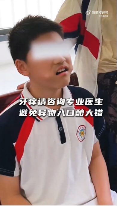 视频|男孩换牙期神操作！嘴卡三角尺全网傻眼