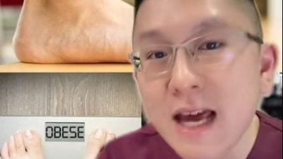 视频| 足底筋膜发炎长骨刺 医生：”这几类人“是高风险群