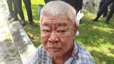 车祸受惊吓记不起住址 老翁送院寻亲属