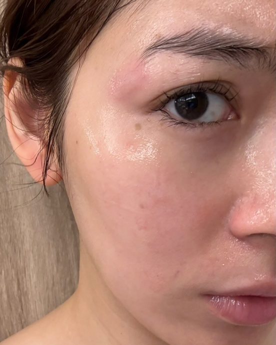 遭电卷棒砸脸被烫伤破相 刘倩妏控台发廊冷处理