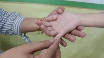 霹手足口症病例上升 截至5月3日逾1.1万宗