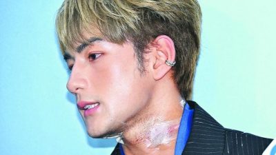 魏浚笙受伤后首现身 获女友每日消毒伤口