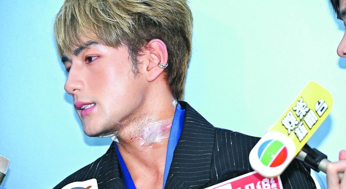 魏浚笙受伤后首现身 获女友每日消毒伤口