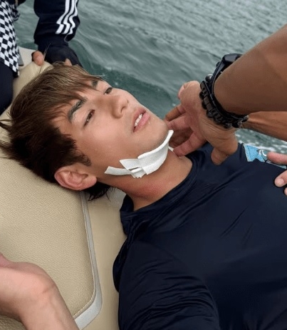 魏浚笙受伤后首现身 获女友每日消毒伤口