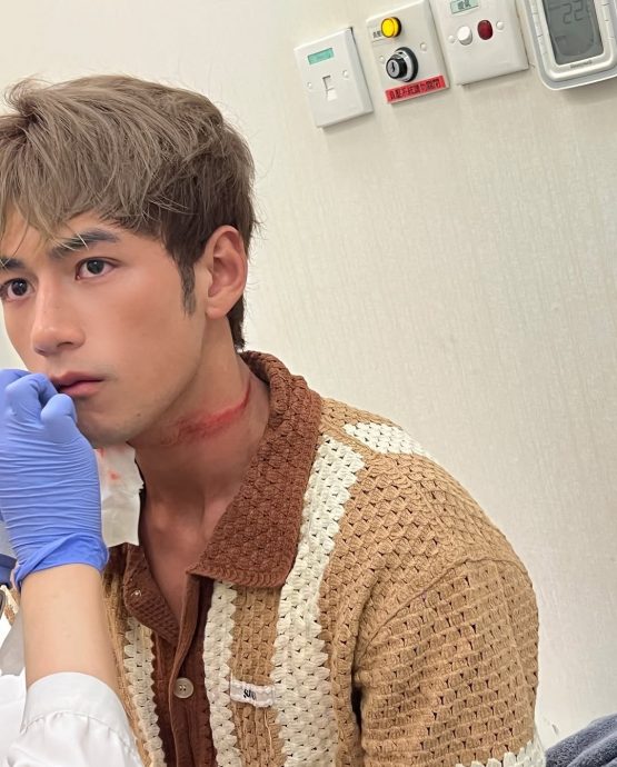 魏浚笙海上拍戏爆意外 颈部血痕触目惊心