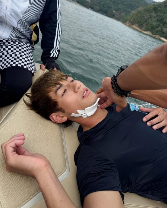 魏浚笙海上拍戏爆意外 颈部血痕触目惊心