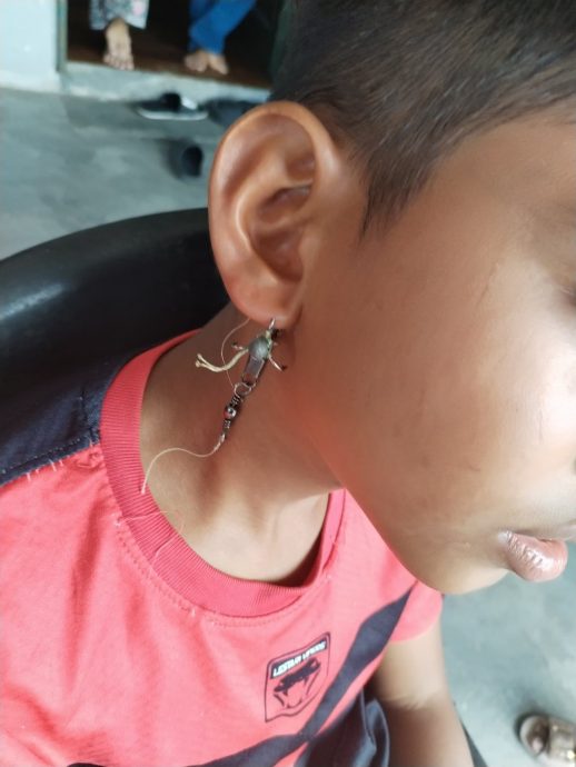 鱼钩刺穿孩子耳朵 消拯员到场吁速送医