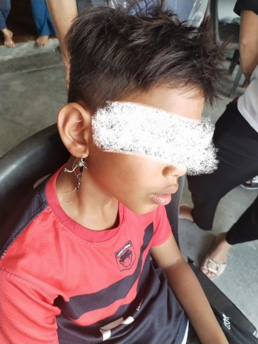 鱼钩刺穿孩子耳朵 消拯员到场吁速送医