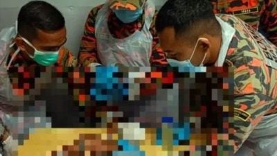 螺母套7指 4坏死   男子被迫截肢保命