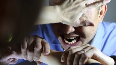 公园救人被袭  男子手掌被咬掉肉
