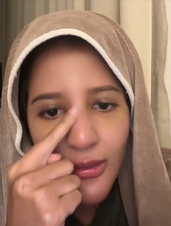 （有视频）取出脸部整形填充物 艺人妻子鼻梁下巴变歪 