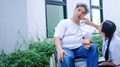 半边脸垮别轻忽 额头动静藏警讯 中风可皱眉 贝尔氏连眉头都“瘫”了