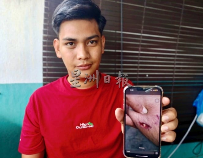 供星洲网:男子被流浪狗咬伤,森大臣派人送慰问金