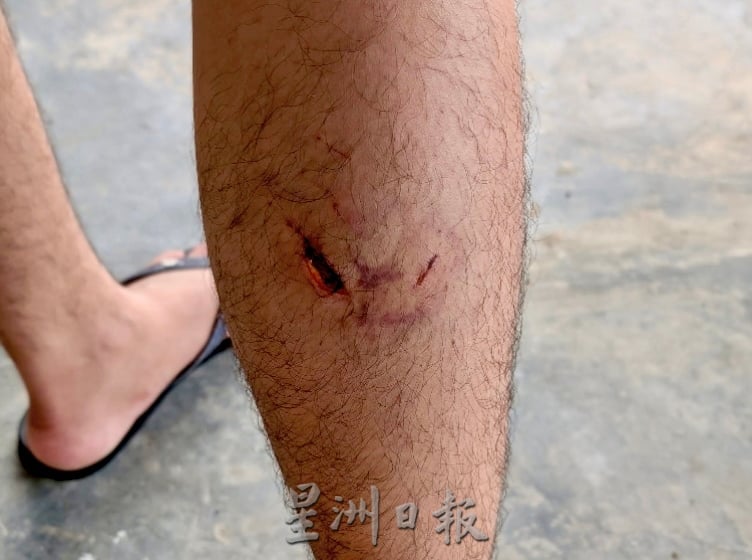 供星洲网:男子被流浪狗咬伤,森大臣派人送慰问金