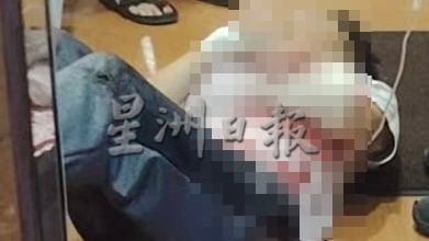 3蒙面人砍伤华男 警捕2嫌犯