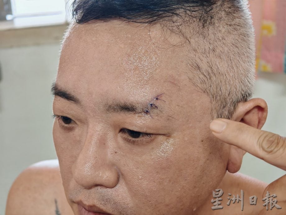 骑摩托返家被攫夺，邱培栋援助1000令吉