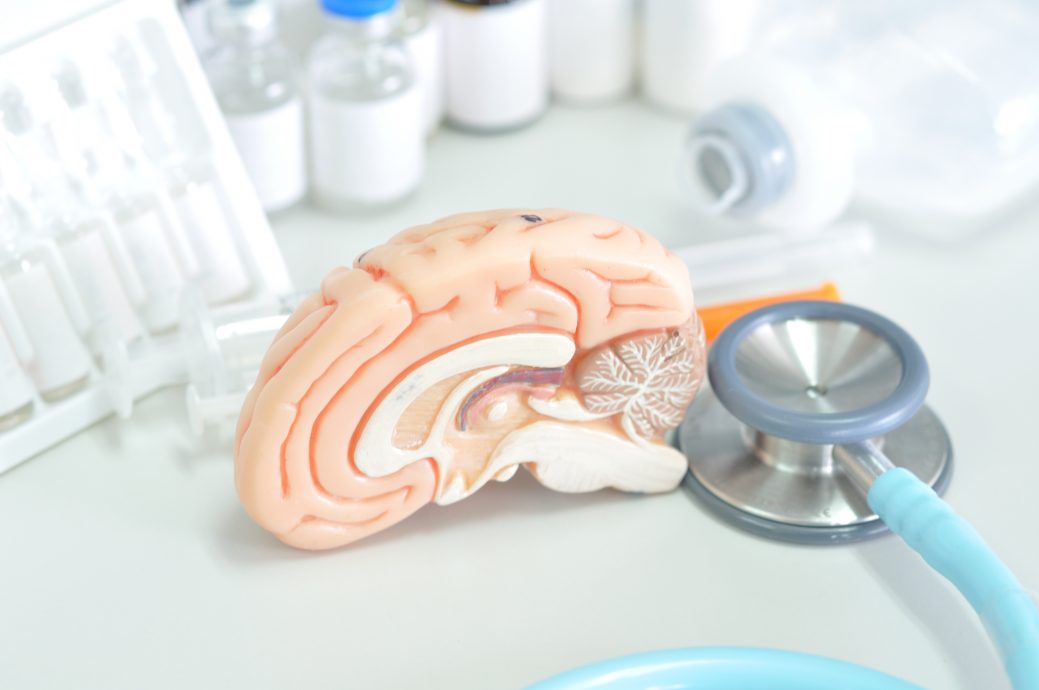 04/成人的大脑还能重塑自己吗？