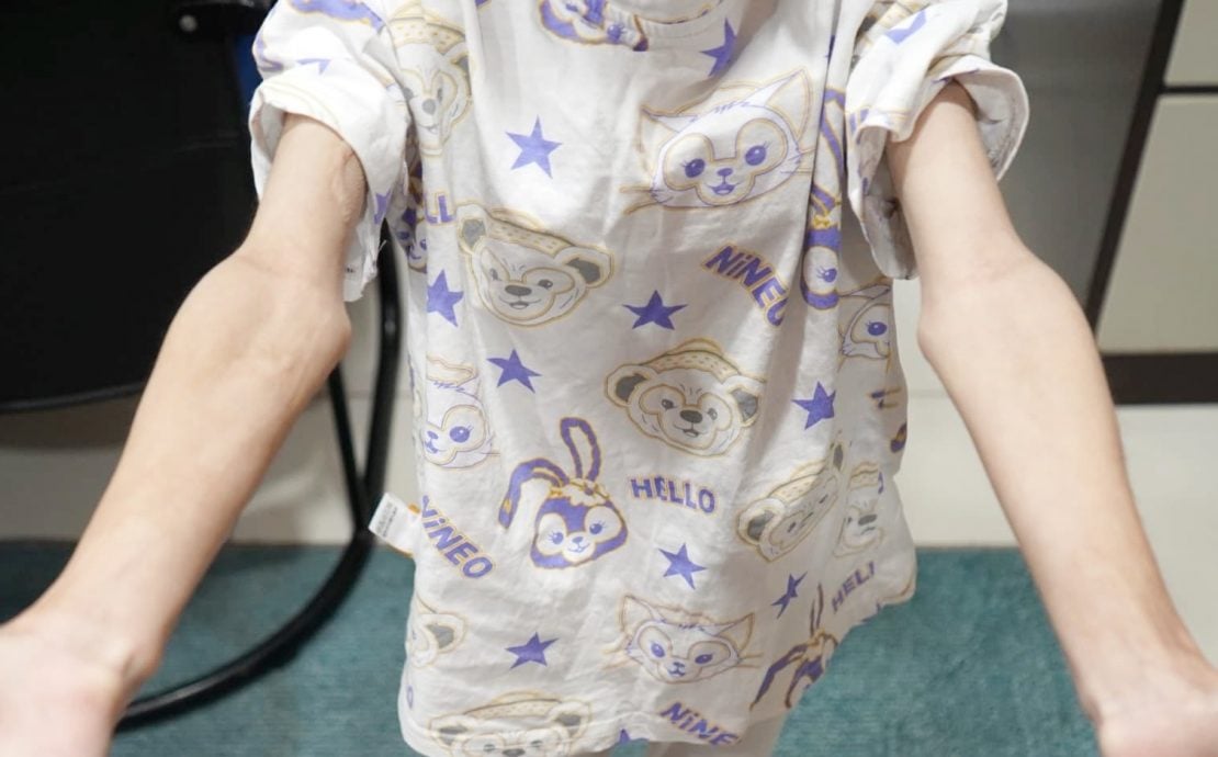 11岁华小生疑被父母虐待满身伤,父母落网前一天指顽皮鞭打女儿