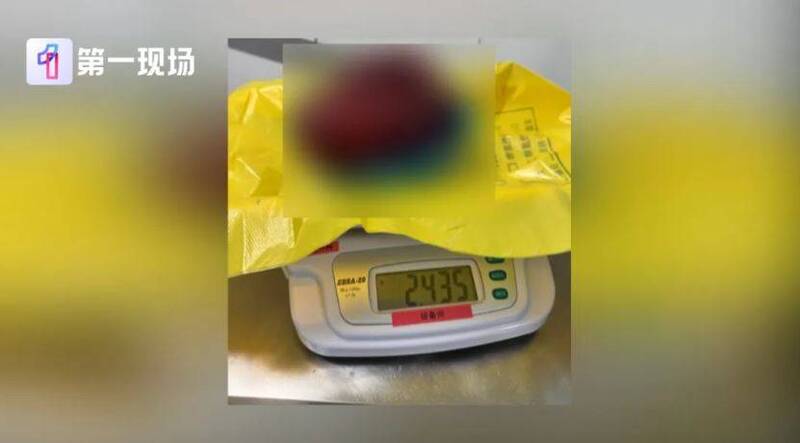 17岁女试穿裤子被店员提醒肚子太大 竟查出27公分超大肿瘤