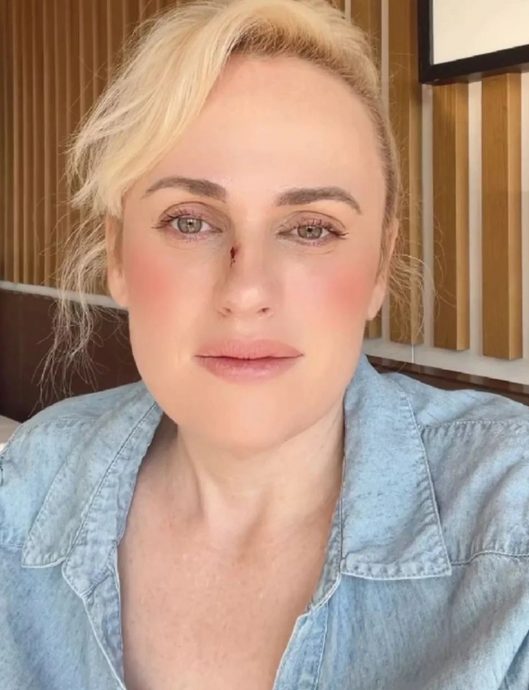 丽贝威尔森新片变身打女 鼻子遭枪托砸裂紧急送医