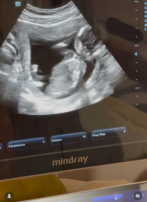 云镁鑫生日报喜认怀孕 喊话阿泽要努力赚奶粉钱