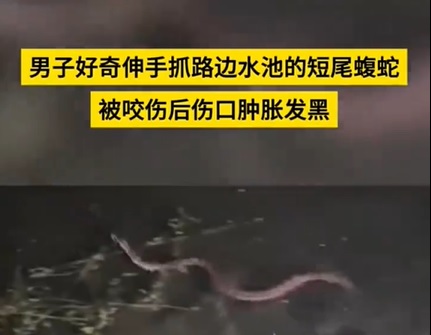 供星洲网：视频|男子好奇抓短尾蝮蛇被咬 手肿胀发黑急送医