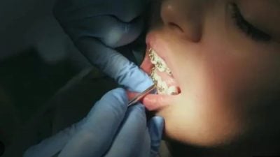 外貌羞辱还是善意提醒？ 陌生人嫌她“笑容露齿不好看”引热议