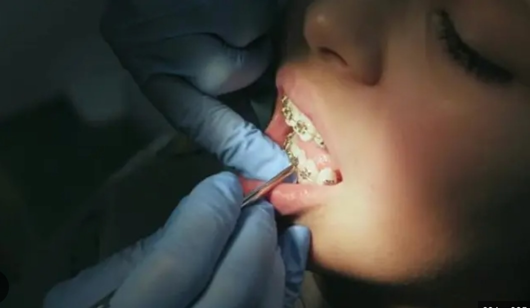 外貌羞辱还是善意提醒? 陌生人嫌她“笑容露齿不好看”引热议