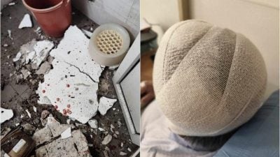 厕所天花板无预警塌落  男子头部受伤缝十多针