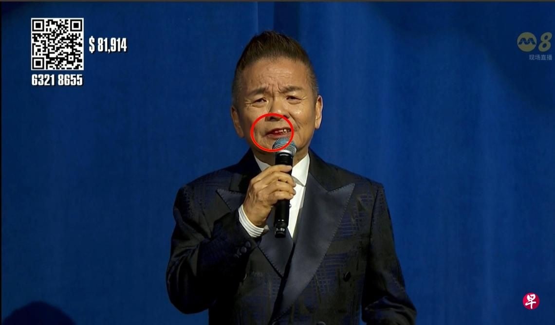 *已签发*柔:狮城二三事:参与《心手相连》直播 陈建彬嘴角有血吓坏观众