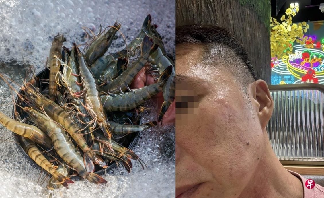 点老虎虾却来其他虾 狮城男吃后过敏起疹