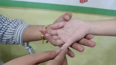 幼儿园严正以待不松懈 霹手足口症呈下降趋势