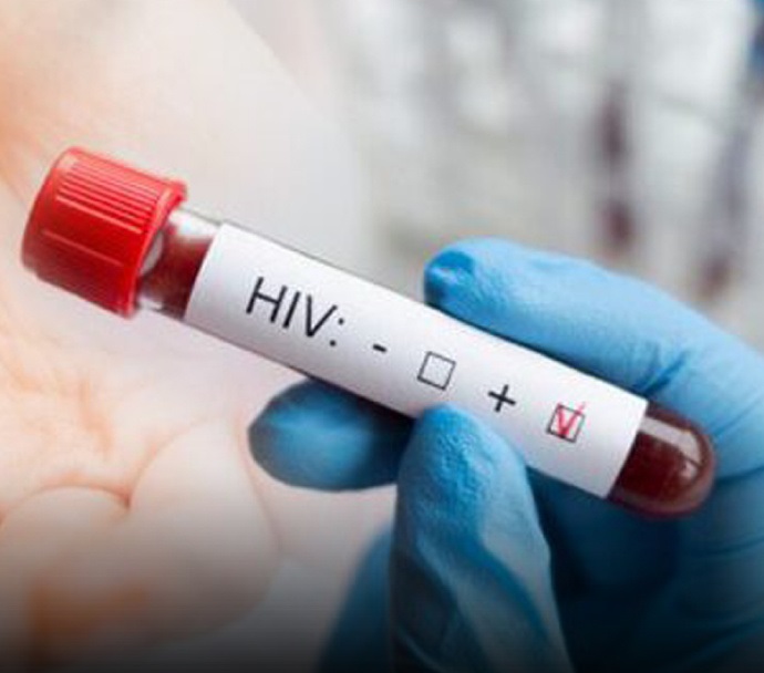 普吉HIV新增244例 累计感染者逾6000人