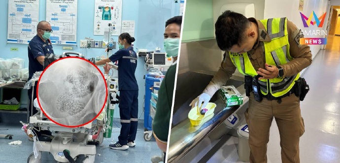 男子机场突痉挛露馅 吞255颗毒胶囊闯关失败